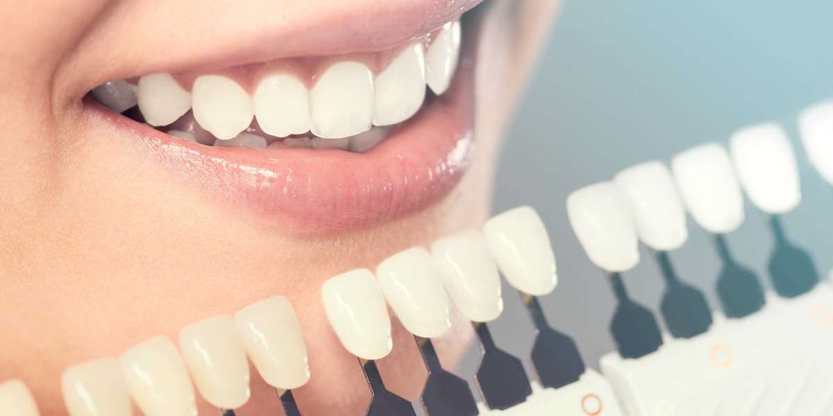 Comprehensive Dentistry for Adults: Your Guide to Optimal Oral Health in McKinney, Texas