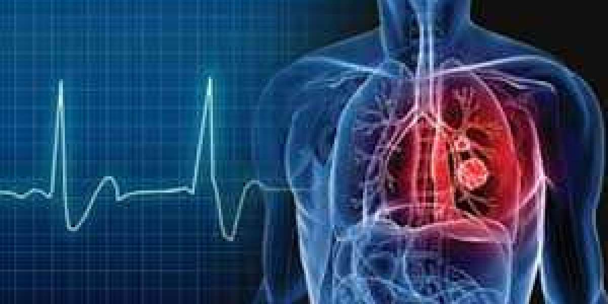 Advanced Electrophysiology in Chennai: Advanced Diagnosis and Treatment