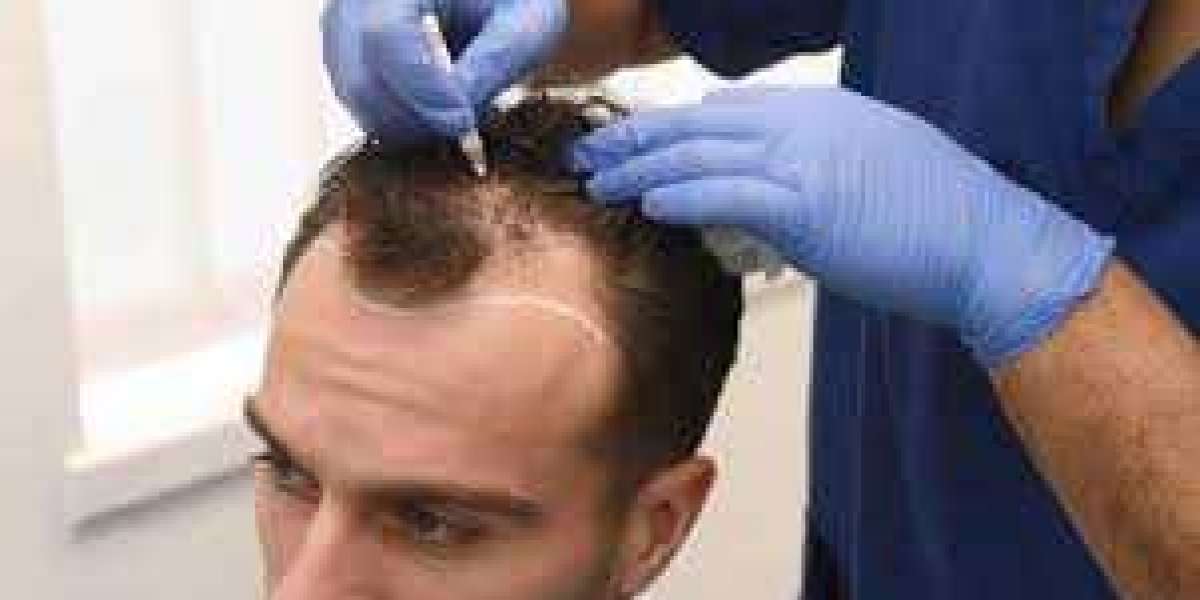 Diet to Prevent Hair Loss